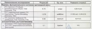 Тиреотоксикоз анализы расшифровка