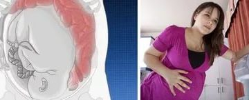 Кишечник или беременность Кишечник или беременность