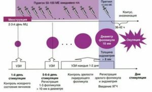 Тонкий эндометрий при стимуляции овуляции клостилбегитом