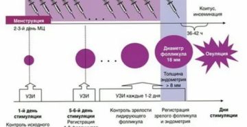 Тонкий эндометрий при стимуляции овуляции клостилбегитом Тонкий эндометрий при стимуляции овуляции клостилбегитом