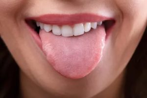 Жжение языка, трещины, отпечатки зубов на языке