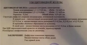 УЗИ щитовидной железы, непонятное заключение