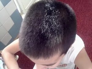 Седые волосы в 14 лет