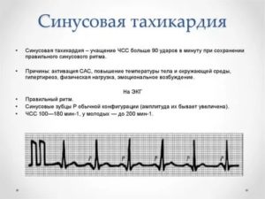 Тахикардия от тироксина, есть ли необходимость принимать постоянно