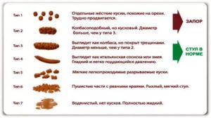 Консистенция стула после года