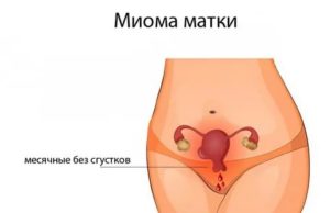 Менструация без сгустков