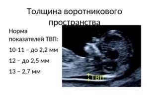 ТВП 2.6 это норма?