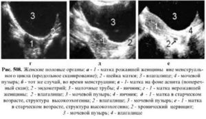 Узи маточной трубы расшифровка