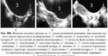Узи маточной трубы расшифровка Узи маточной трубы расшифровка