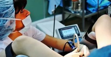 Скудные месячные после Гистероскопии Скудные месячные после Гистероскопии