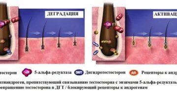 Повышен дигидротестостерон Повышен дигидротестостерон