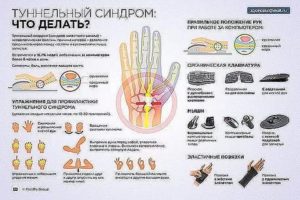 Боль в пальце при сгибании