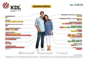 Повышен СА 72-4 может это быть онкология?