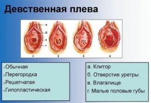 Какое у меня строение девственной плевы