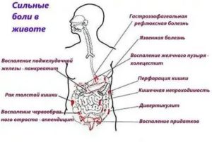 Боль слева внизу живота и в прямой кишке