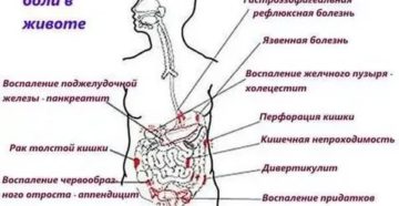 Боль слева внизу живота и в прямой кишке