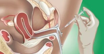 Беременность, если сесть на сперму