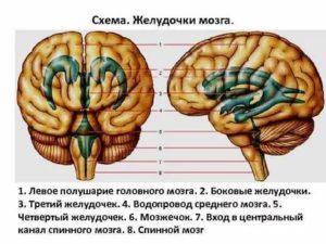 3й желудочек мозга меньше нормы