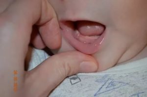 Прививки при прорезывании зубов