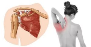 Боли в плечевом суставе и в районе лопатки