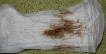 Коричневые выделения в первый день менструации Коричневые выделения в первый день менструации