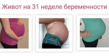 Здравствуйте! У меня 20 неделя беременности и 3день живот в тонусе