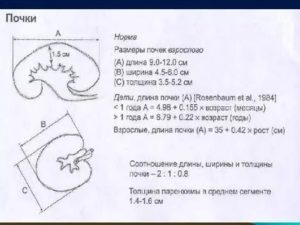 Толщина паренхимы почки 5,5 мм