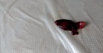 Медикаментозный аборт при внематочной беременности Медикаментозный аборт при внематочной беременности