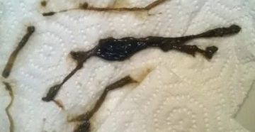 Коричневая мазня в середине цикла и во время месячных! Коричневая мазня в середине цикла и во время месячных!