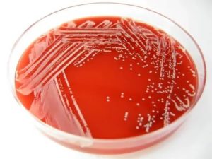 Staphylococcus lugdunensis