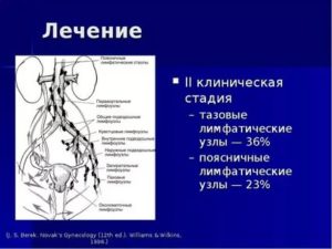 Отчего могут увеличиваться парааортальные лимфоузлы