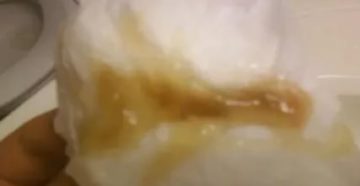 Беременность 32 недели коричневые и бежевые выделения Беременность 32 недели коричневые и бежевые выделения