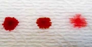 Кровеподобные выделения на фоне приема силует Кровеподобные выделения на фоне приема силует