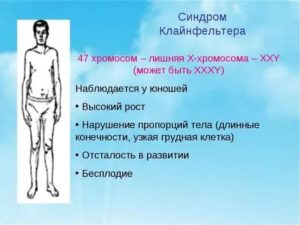 Синдром клайнфельтера