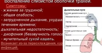 Трахеит или осложнения?