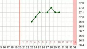 Температура 36,9-37,1 в течение месяца