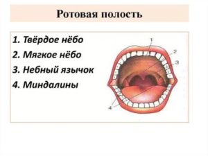 Образование на мягком небе