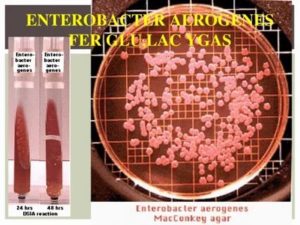 Нужен ли антибиотик? Streptococcus gr. Viridans, Enterobacter aerogenes10(5)