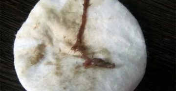 Коричневые выделения, температура Коричневые выделения, температура