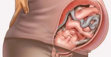 Тонус матки на 4 месяце Тонус матки на 4 месяце