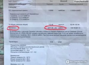 Пролактин. Назначение достинекса