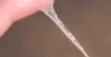 Прозрачные выделения как сопли Прозрачные выделения как сопли