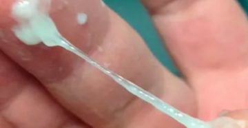 Пузырьки воздуха из влагалища