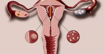 Стоит спираль можно ли мужу кончать в меня