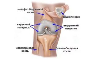 Травма колена, контузионные изменения бедренной кости