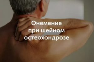 Онемение и шейный остеохондроз