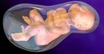 Маловодие на 21 неделе беременности Маловодие на 21 неделе беременности