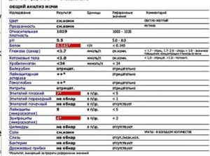Гемоглобин + и следы крови в моче ребенка