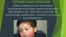 Тромбоцитопатия у ребенка