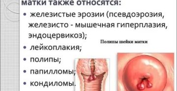Болезни шейки матки Болезни шейки матки